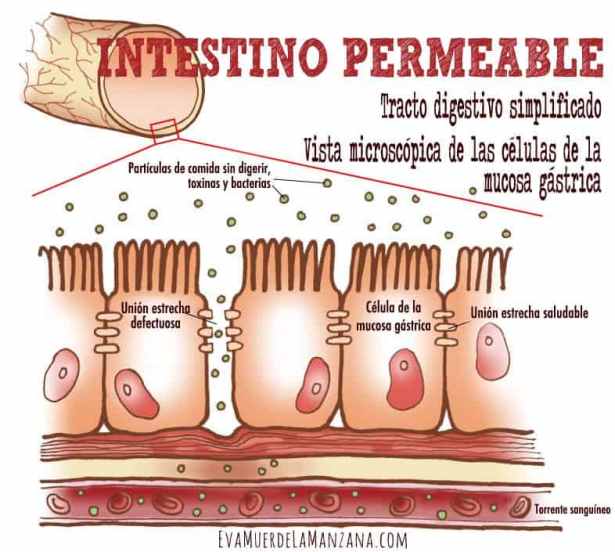 Diagrama permeabilidad intestinal aumentada Diagrama permeabilidad intestinal aumentada