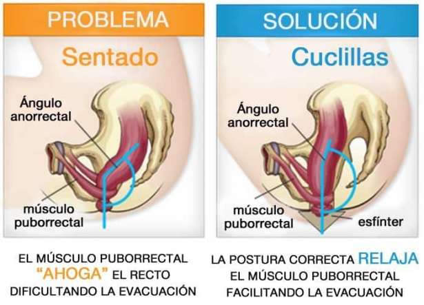 Postura correcta estreñimiento Postura correcta estreñimiento