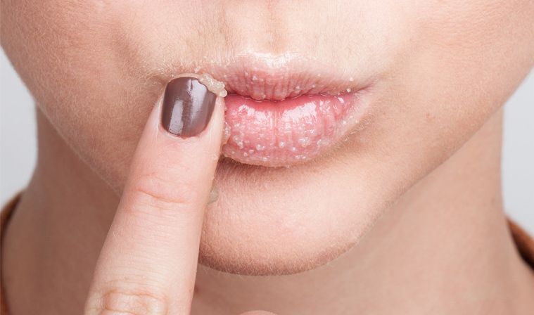 Exfoliante para labios a base de miel, aceite de almendra y azúcar de coco Exfoliante para labios a base de miel, aceite de almendra y azúcar de coco